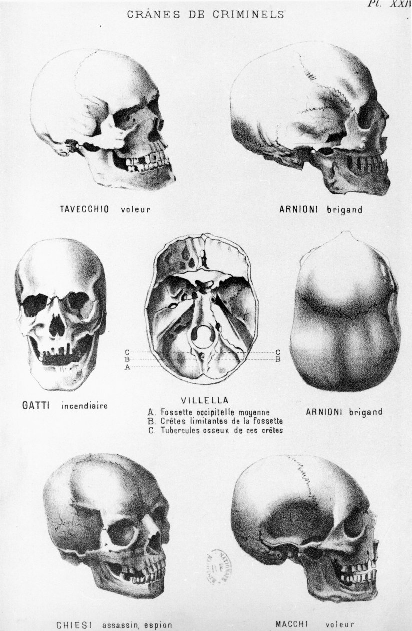 Skulls of Murderers, fra LHomme Criminel av Cesare Lombroso (1835-1909), utgitt av Felix Alcan, 1887 av Italian School