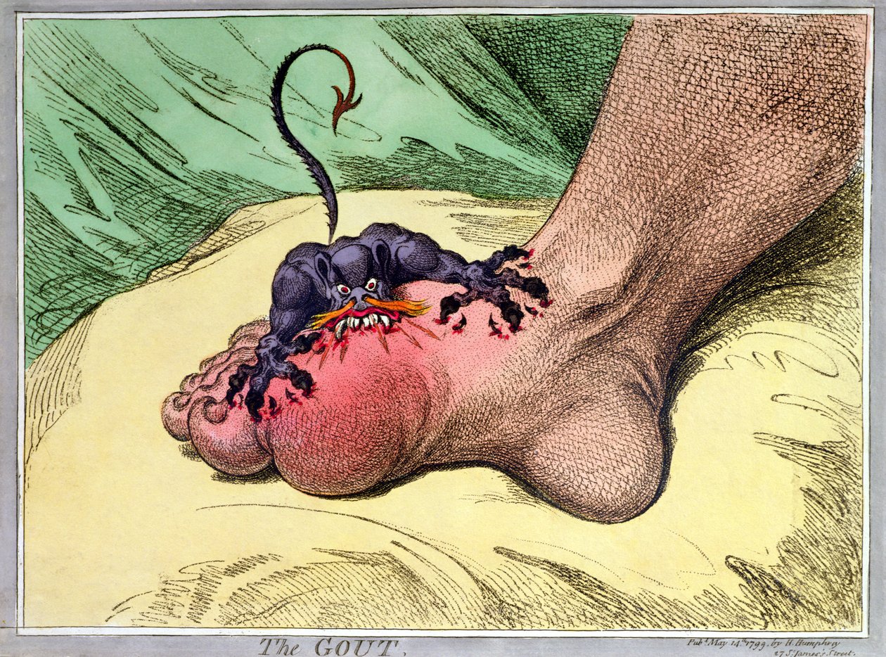 The Gout, utgitt av Hannah Humphrey i 1799 (håndfarget myk grunnetsing) av James Gillray