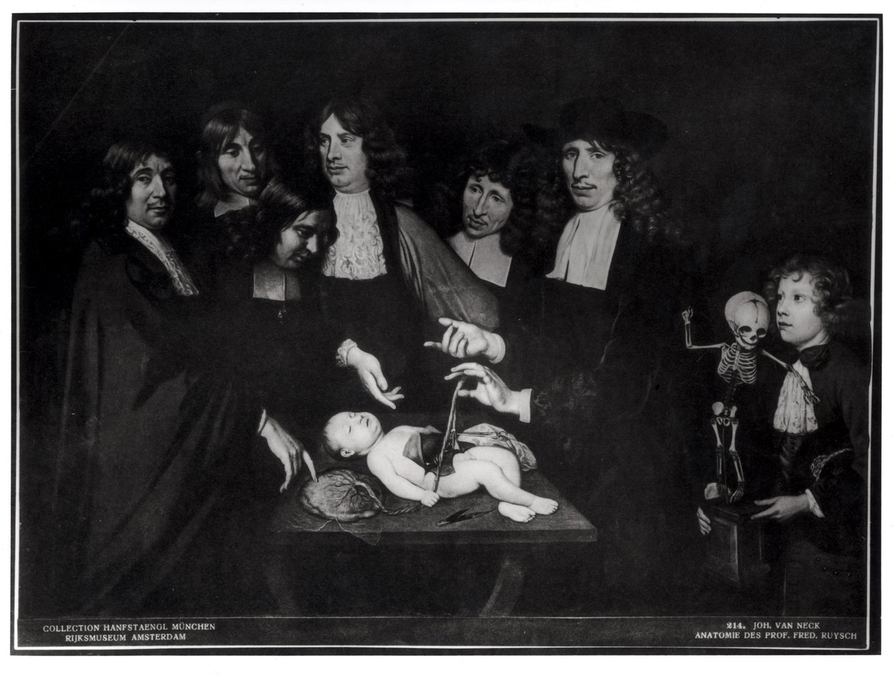 Anatomieleksjonen til professor Frederik Ruysch (1638-1731) ca. 1683 av Jan van Neck