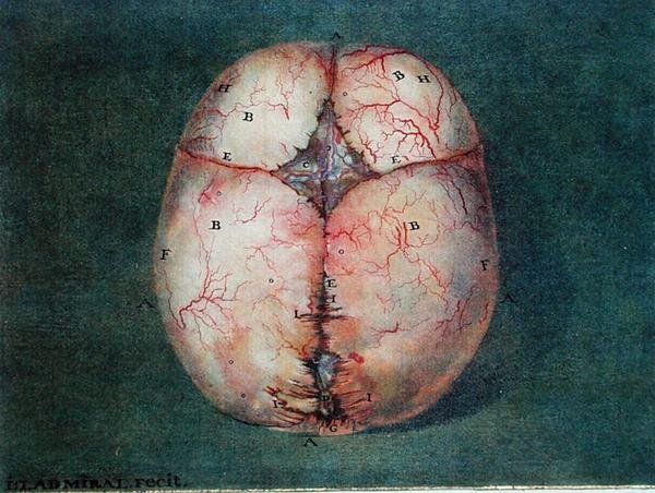 The Brain, fra 