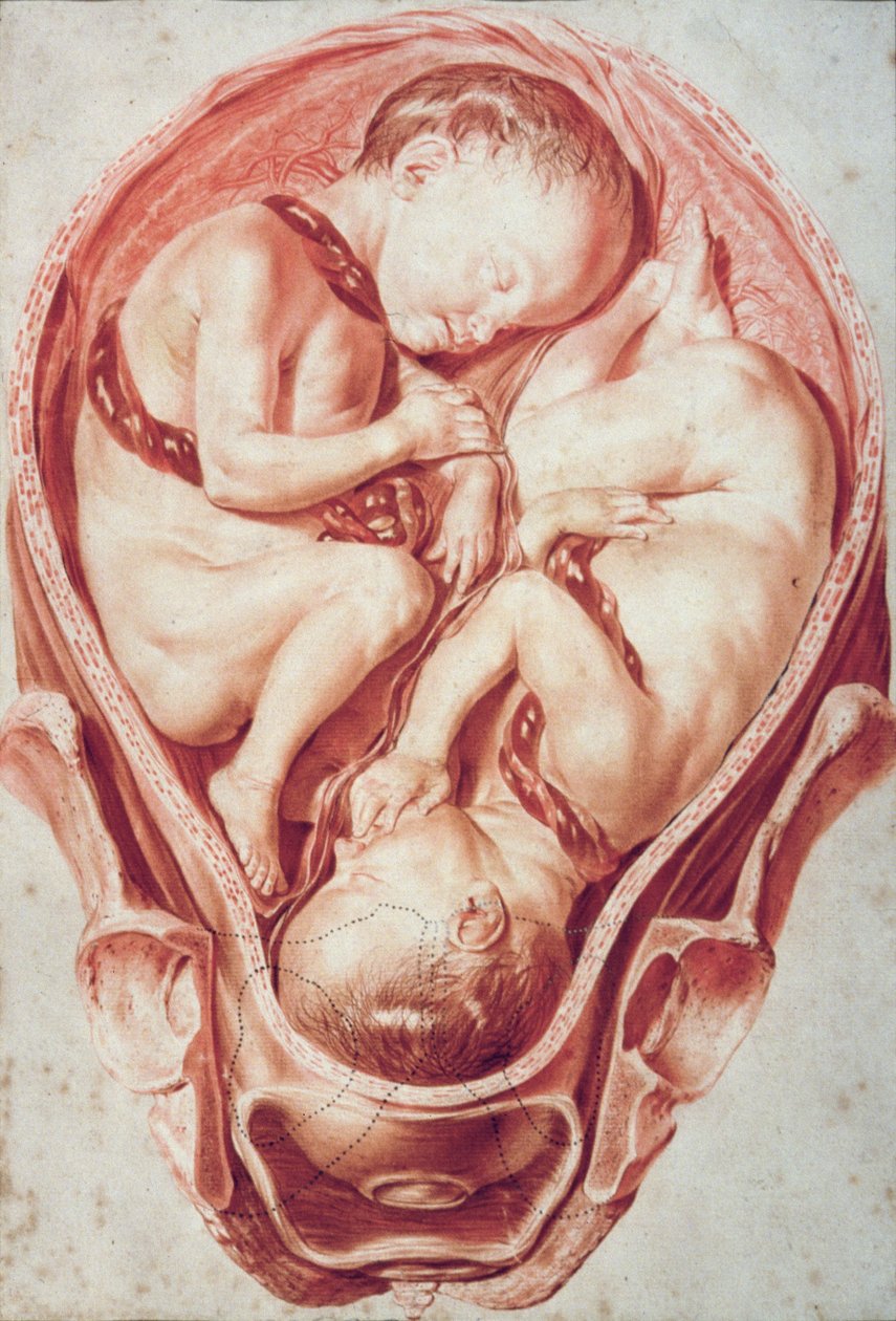 Ms Hunter 654 Plate 10 Tegning fra et sett med obstetriske tegninger for William Smellies (1697-1763) 
