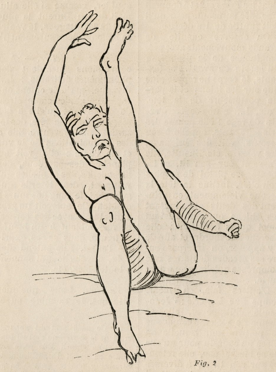 Hysterisk epilepsi, angrep, vridninger, fig. 2 fra 