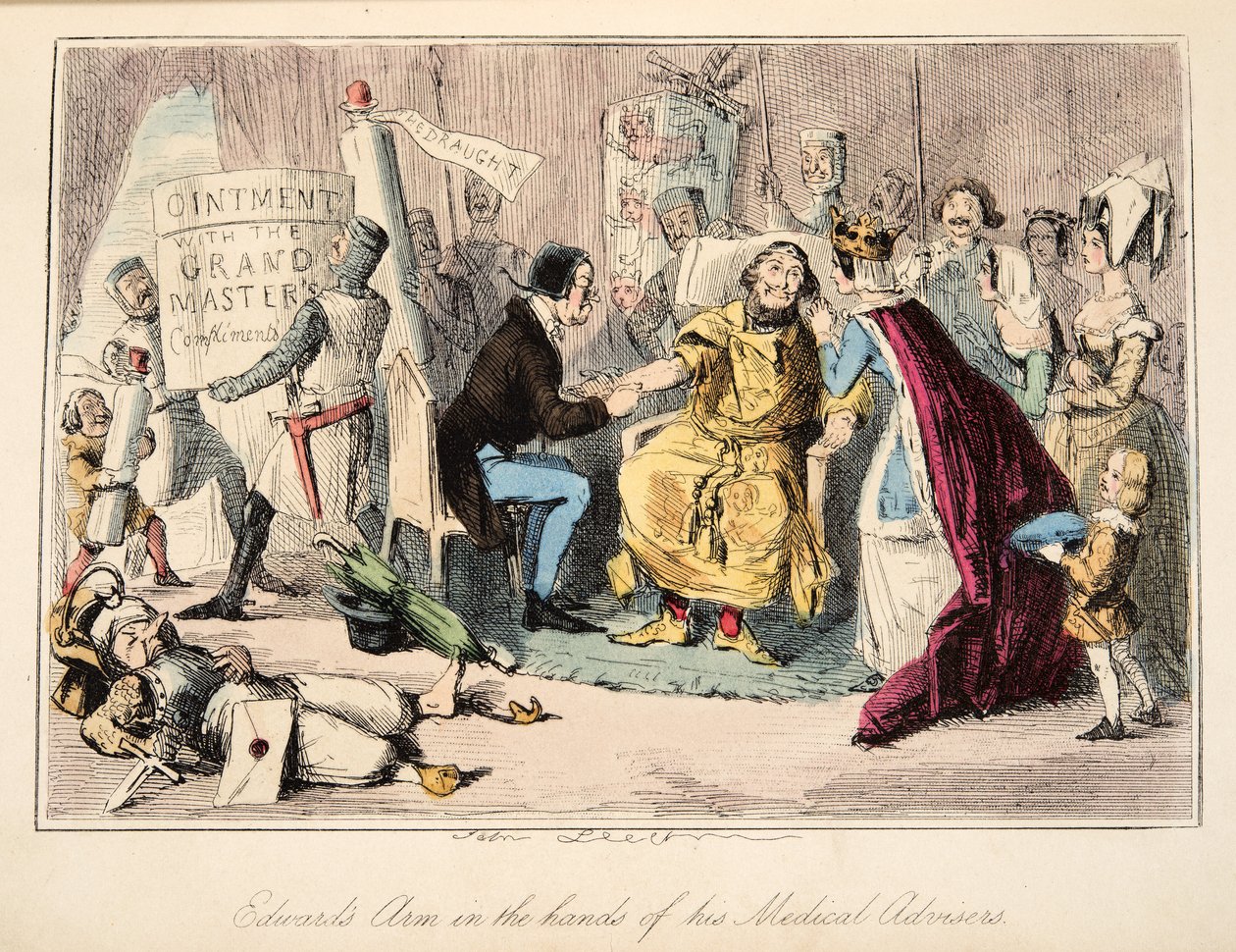 Edward's Arm in the Hands of his Medical Advisers, fra The Comic History of England, pub. 1864 (håndfarget etsning) av John Leech