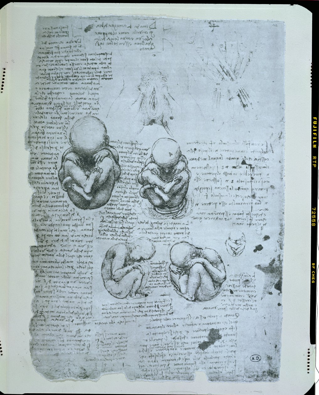 Five Views of a Fetus in the Womb, faksimilekopi av Leonardo da Vinci