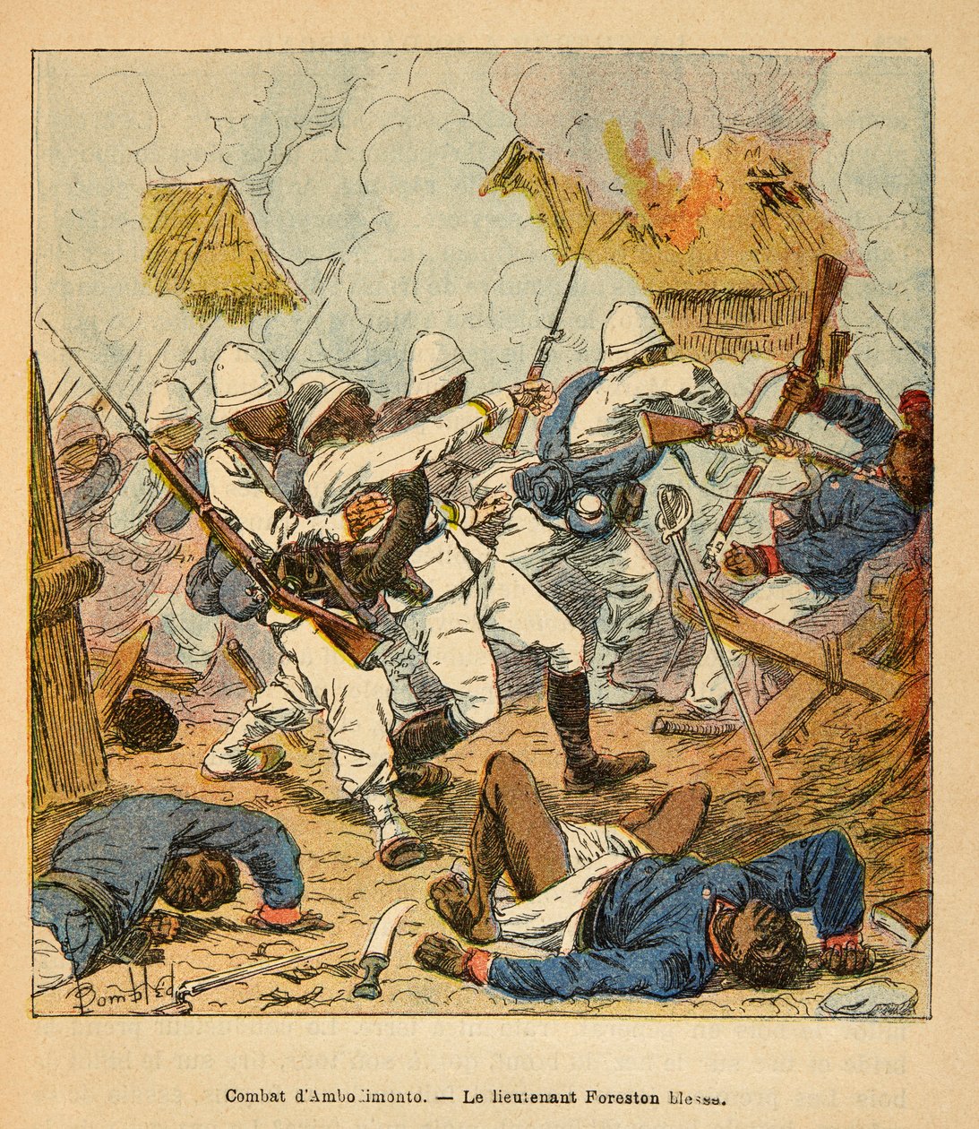 The War in Madagascar-Anecdotal History of the French Expeditions of 1885-1895 av Henri Galli dit Galllichet (1854-1922), illustrert av Louis Bombled (1862-1927): Løytnant Foreston sår under slagene ved Ambolomonty i 1895, privat samling av Louis Charles Bombled