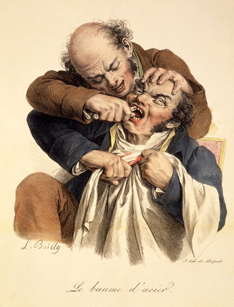 The Steel Balsam - Å ha en tann trukket, pub. i Paris, 1826 av Louis Leopold Boilly