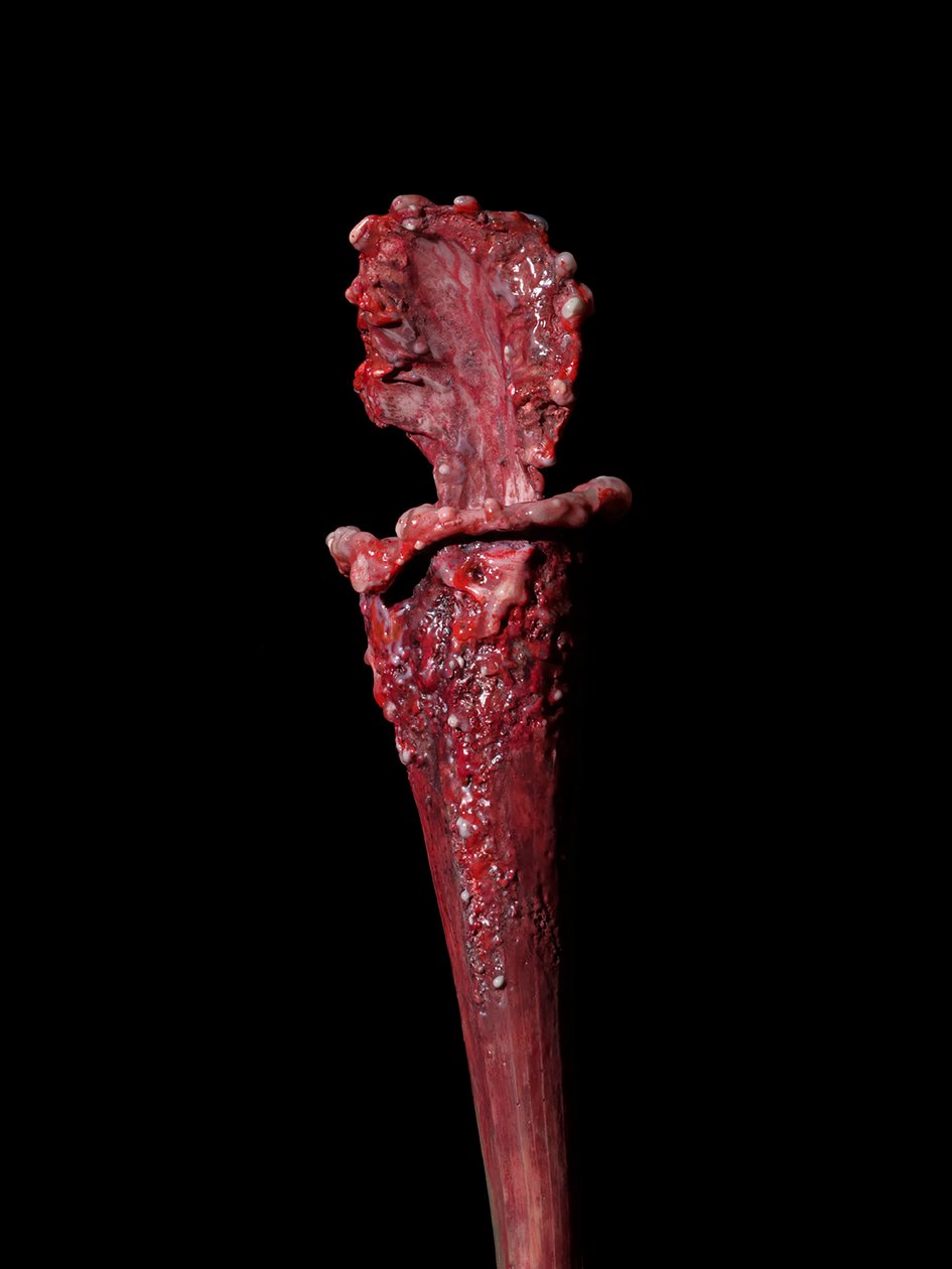 av Mat Collishaw