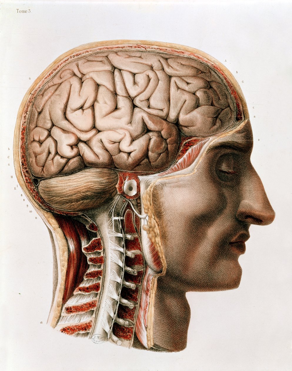 The Brain, tallerken fra 