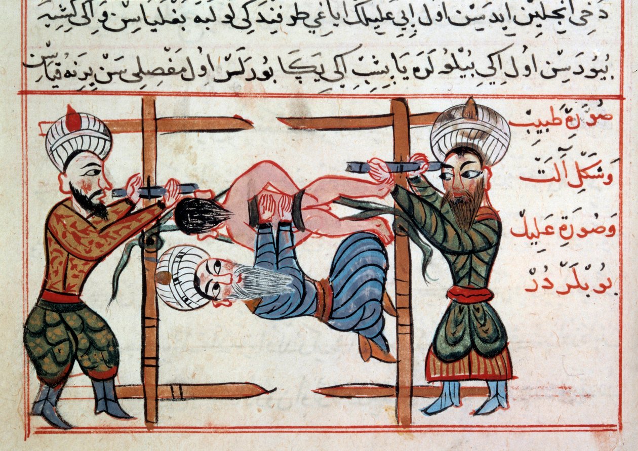 Reduksjon av et brudd. Miniatyr fra en godbit av tyrkisk medisin av Sharaf al-din av Ottoman School