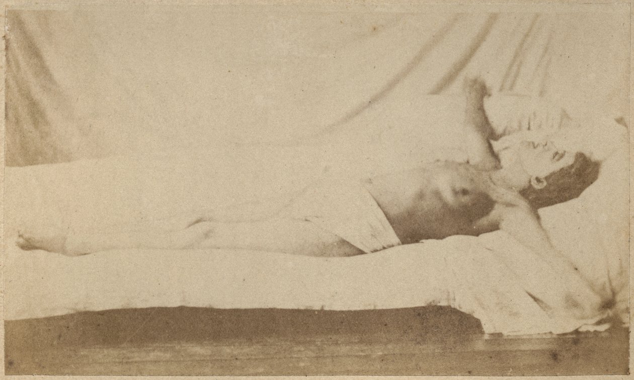Hysterisk epilepsi, angrep, korsfestelse, plate VI fra 