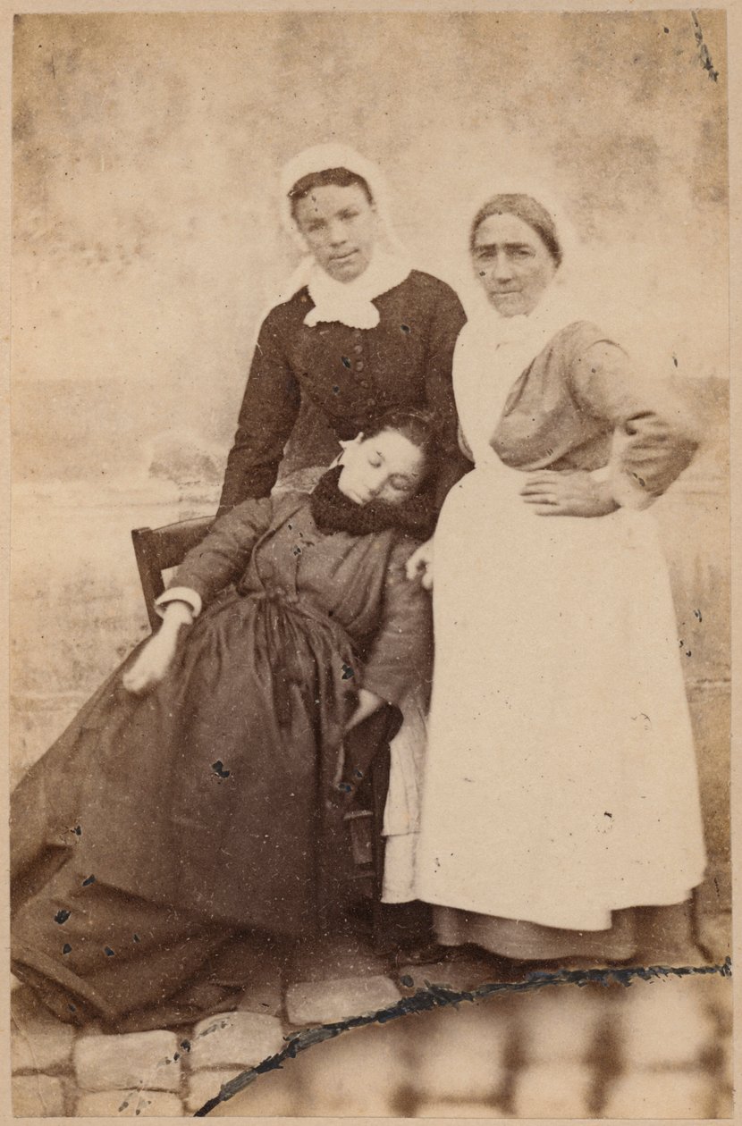 Hysterisk epilepsi, angrep, epileptoid fase, illustrasjon fra 
