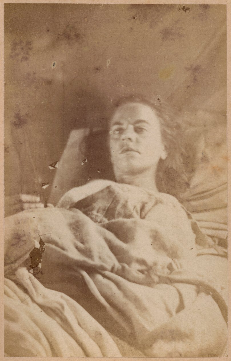 Hysterisk epilepsi, angrep, tredje periode, plate XXVI fra 