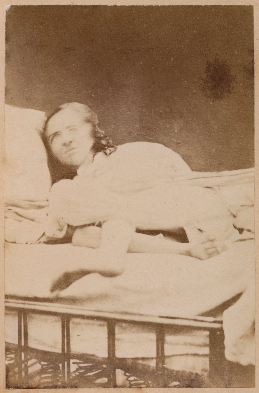 Hysterisk epilepsi, forvrengninger, plate XXXVIII fra 