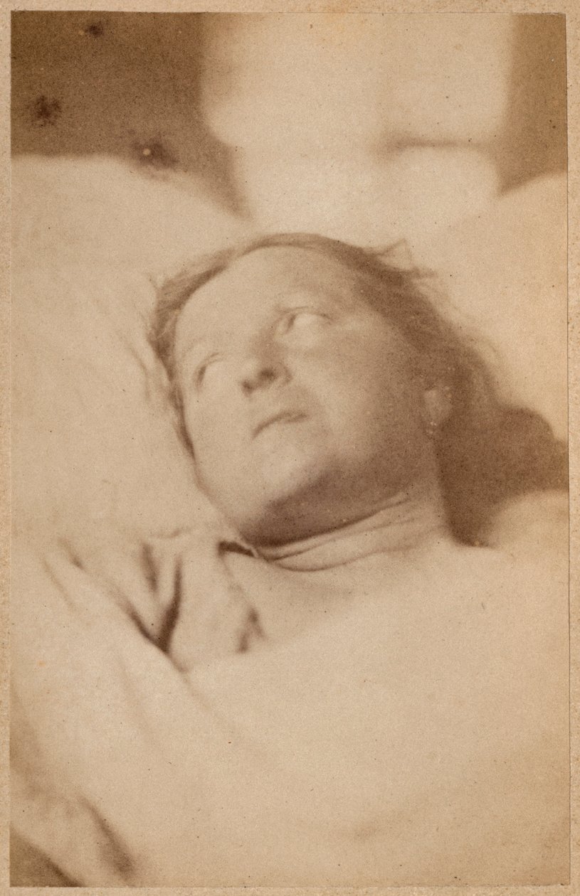 Hysterisk epilepsi, korsfestelse, hodestilling, plate VII fra 