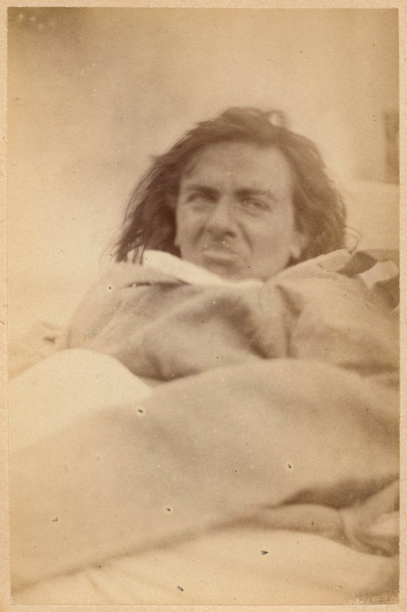 Hysterisk epilepsi, hallusinasjoner, motvilje, plate XXXV fra 