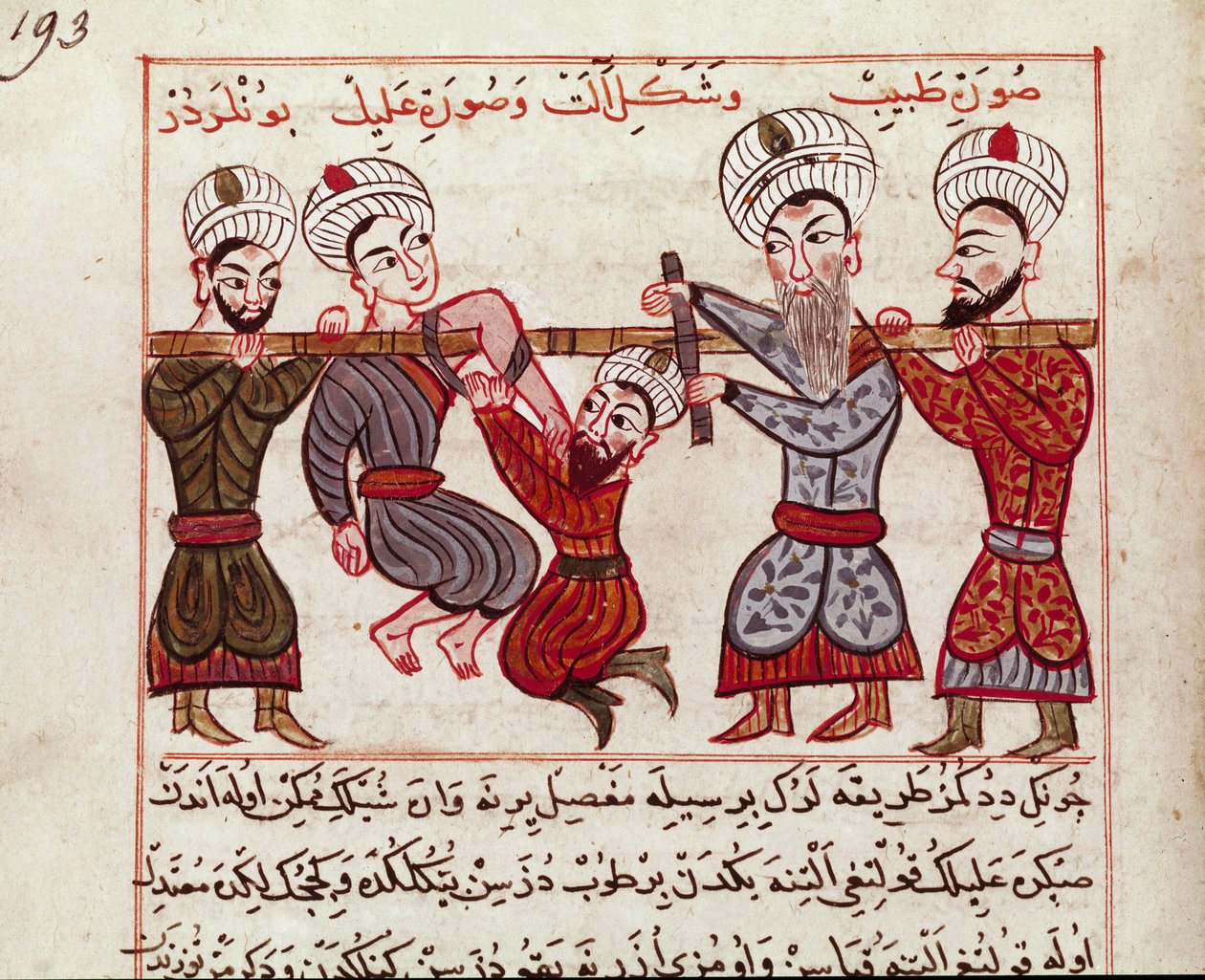 Medisin: ortopedisk intervensjon. Miniatyr tatt fra en melking av tyrkisk medisin av Charaf-ed-din (Charaf ed Din) (1404-1468) etter “” La Surgery Imperiale”” (Ms Sup Turk 693 fol. 193) 1466 Paris, B.N. av Persian School