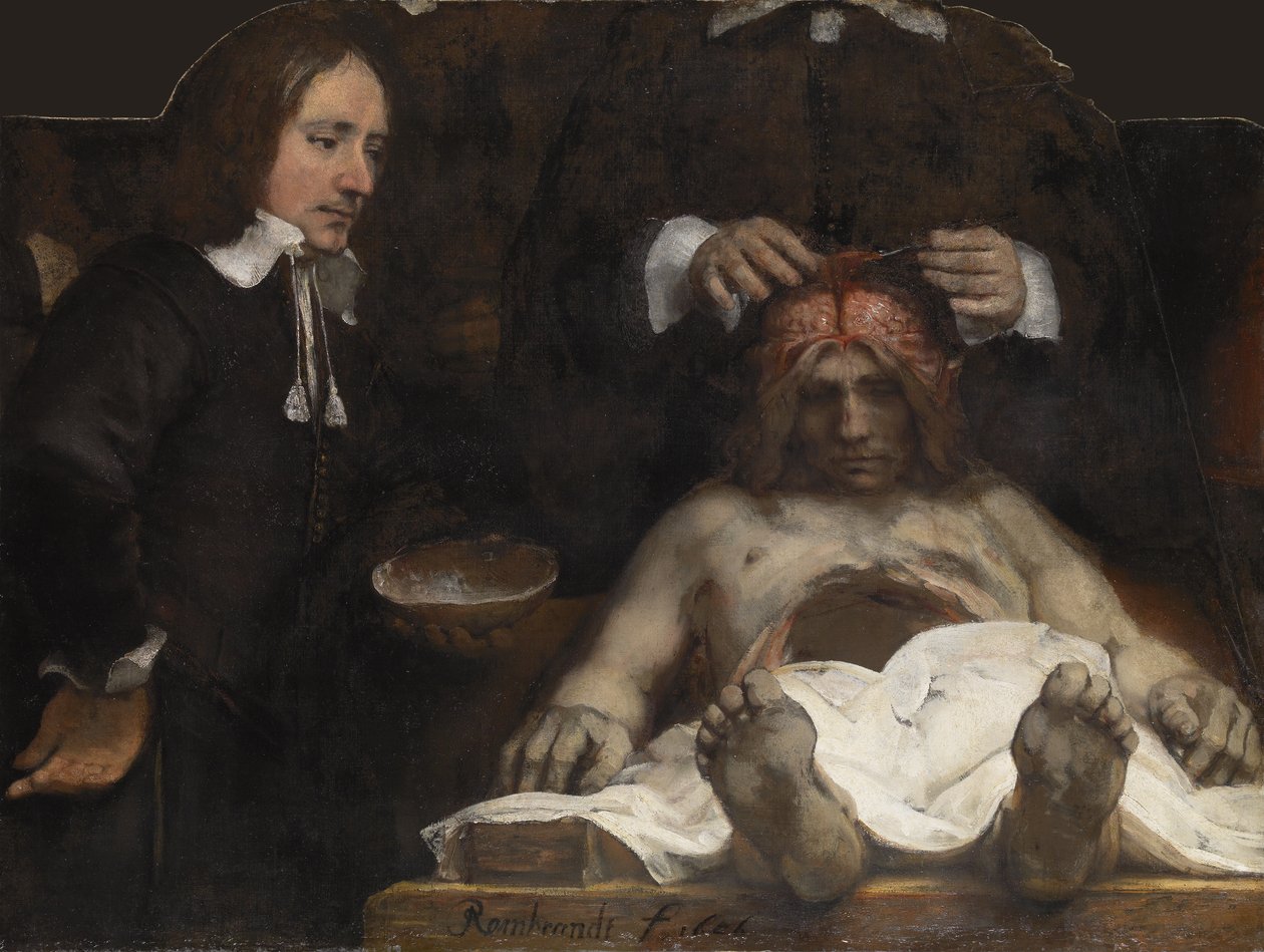 Dr. Jan Deymans anatomi-leksjon, 1656 av Rembrandt van Rijn