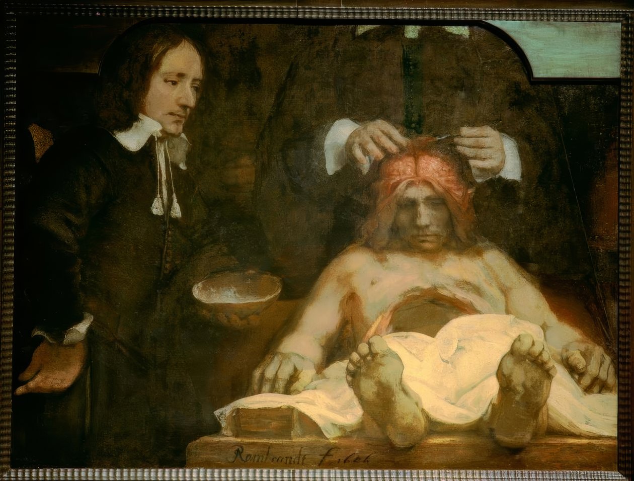 Anatomien til Dr. Johan Deijman av Rembrandt van Rijn