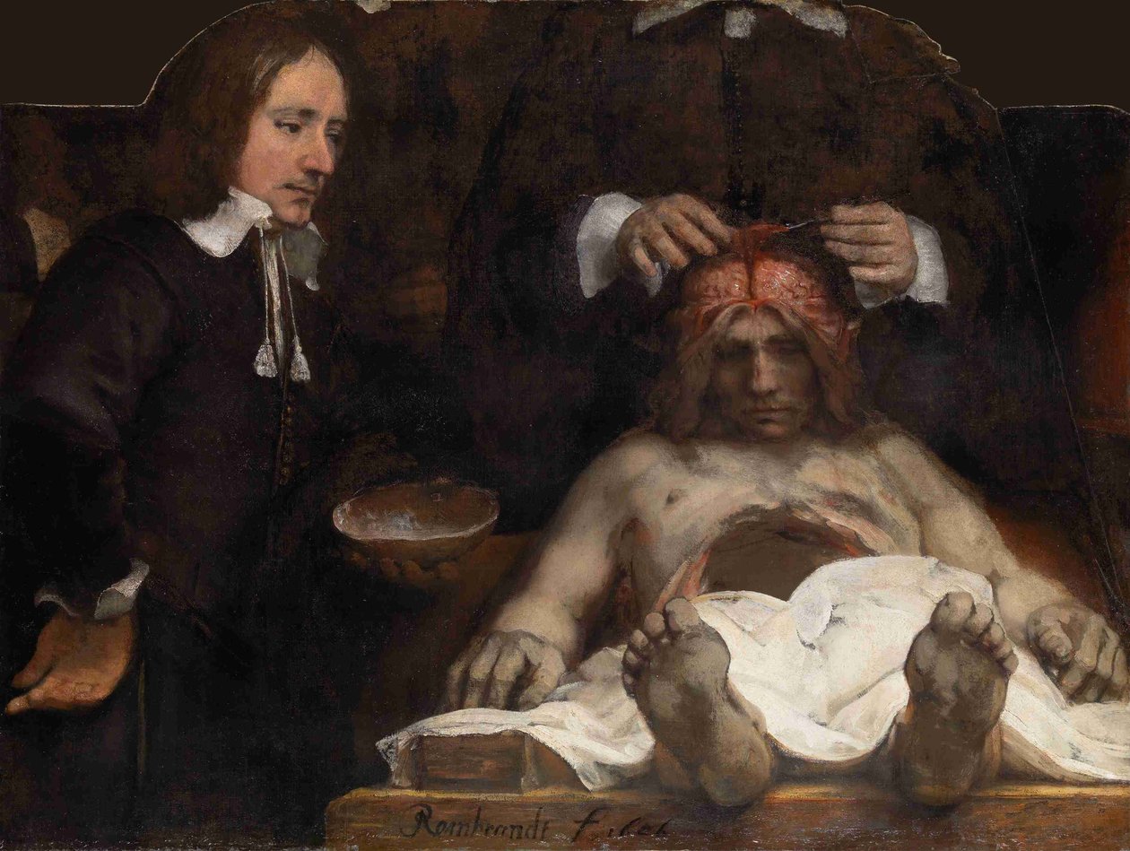 Dr. Jan Deijmans anatomi-leksjon, 1656 av Rembrandt van Rijn