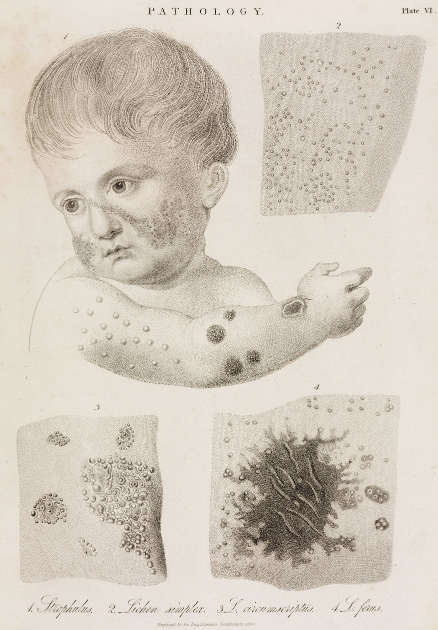 Dermatologi Typer hudsykdom av John Pardon