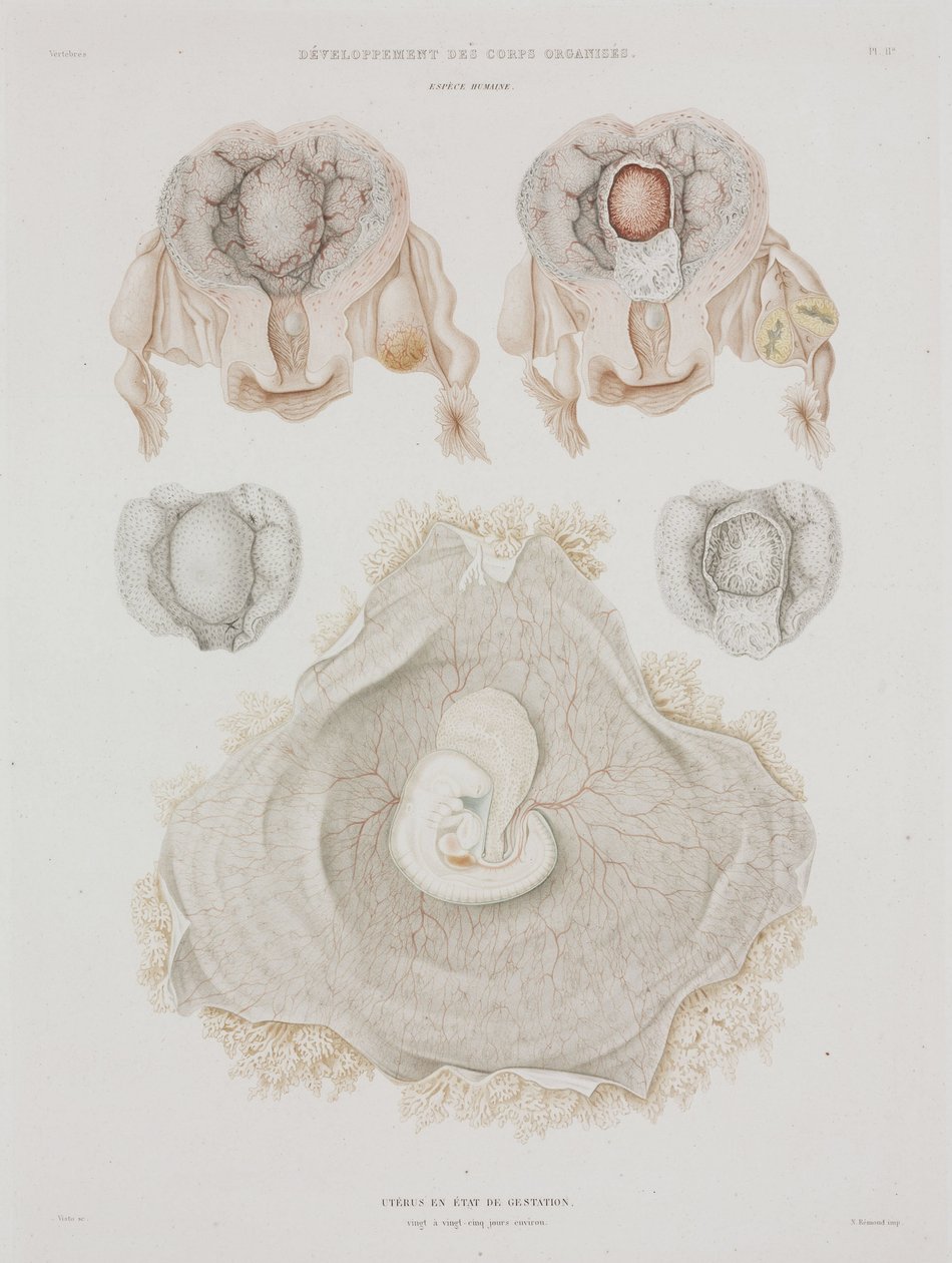 Gynekologi Menneskelig livmor med embryo, ca 1847-1859 av John Pardon