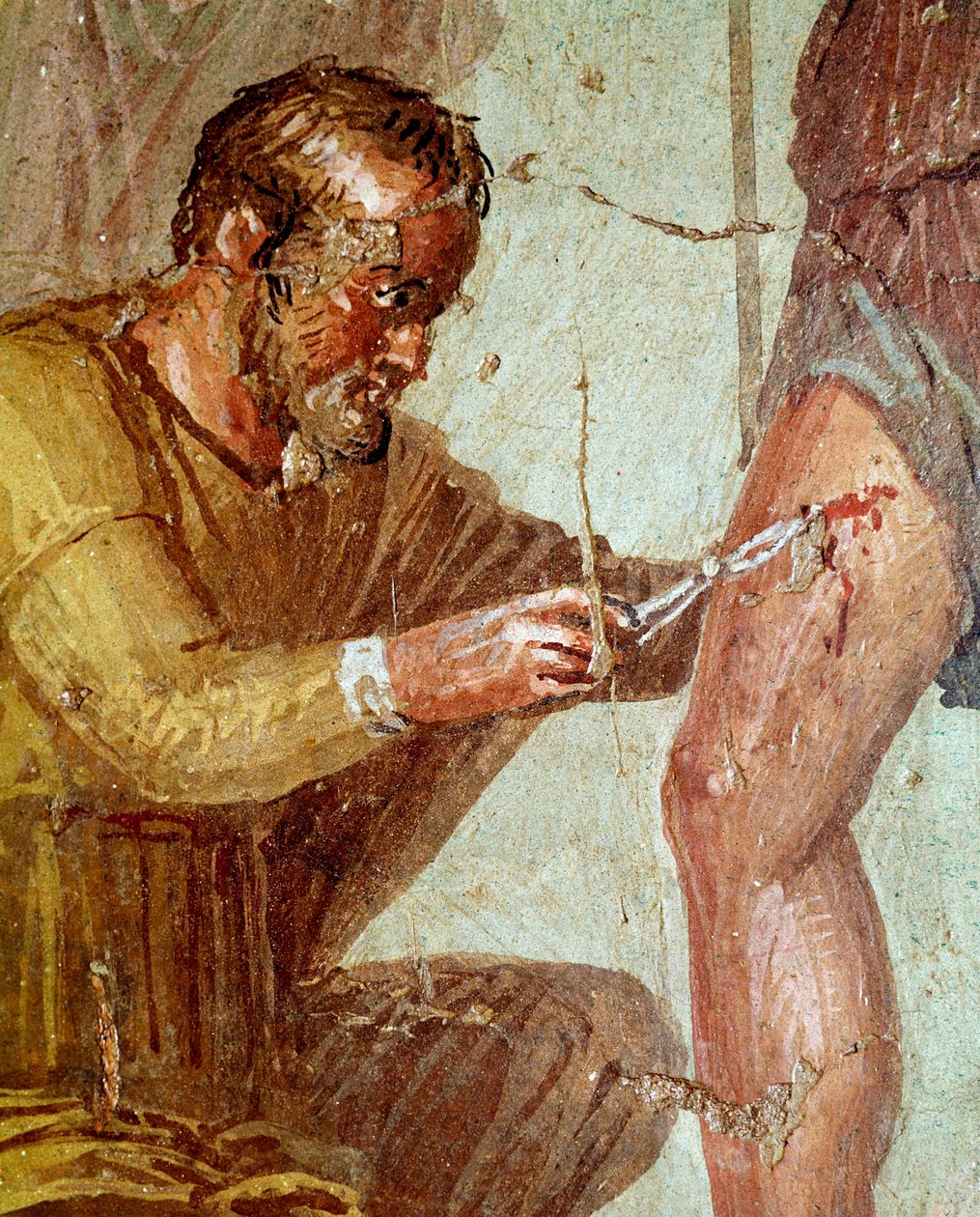 Sårede Aeneas blir behandlet av Iapyx hjulpet av Venus (fresco, 54-79 e.Kr.) av Roman