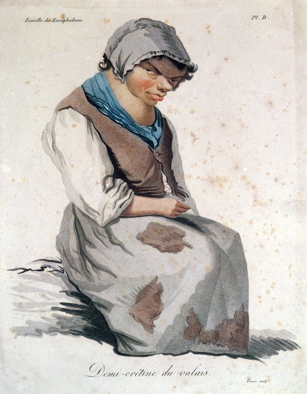 Cretin fra Valais (fargegravering) av Salvadore Tresca