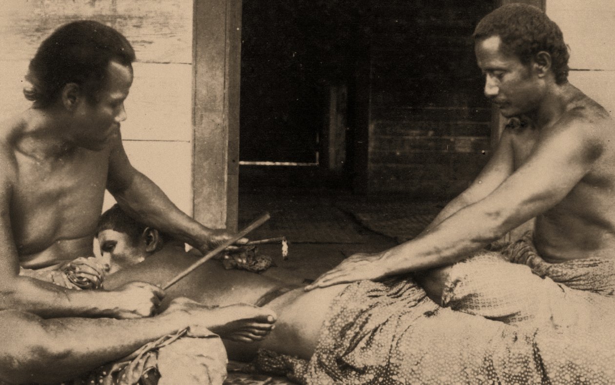 En samoansk mann blir tatovert, ca. 1895 sepia Foto av Samoan
