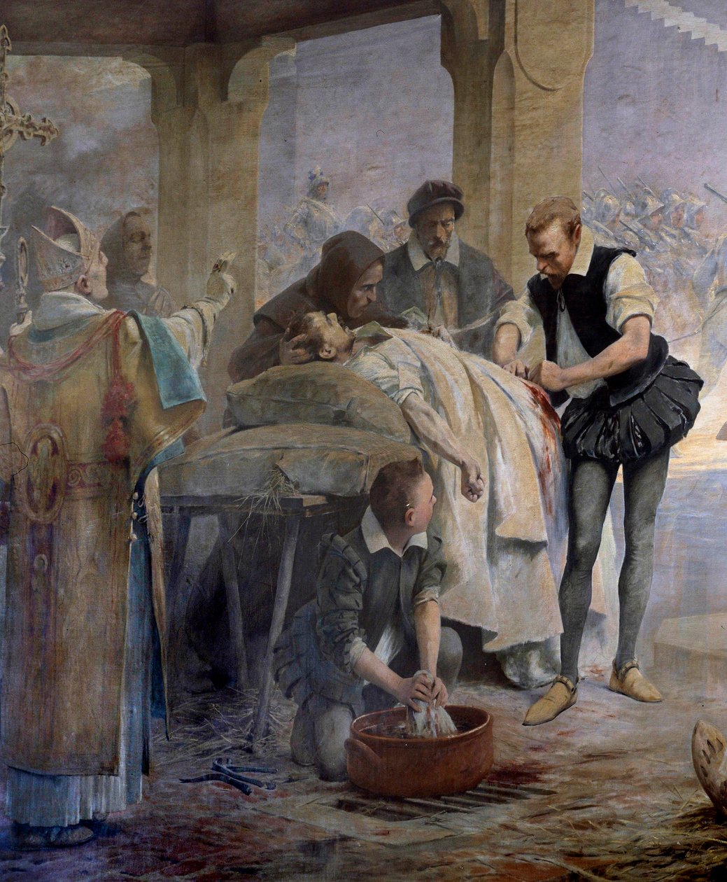 Legen Ambroise Pare (1509-1590) praktiserer ligering av arterene på en harquebusher som ble skadet under beleiringen av Metz av Charles V i 1553 Detail. Maleri av Theobald Chartran (1849-1907) av Theobald Chartran