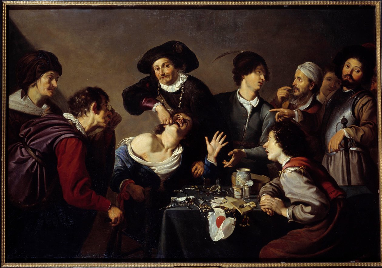 Tannfjerneren En tannlege omgir assistentene sine og instrumentene river en pasients tann. Maleri av Theodore Rombouts av Theodor Rombouts