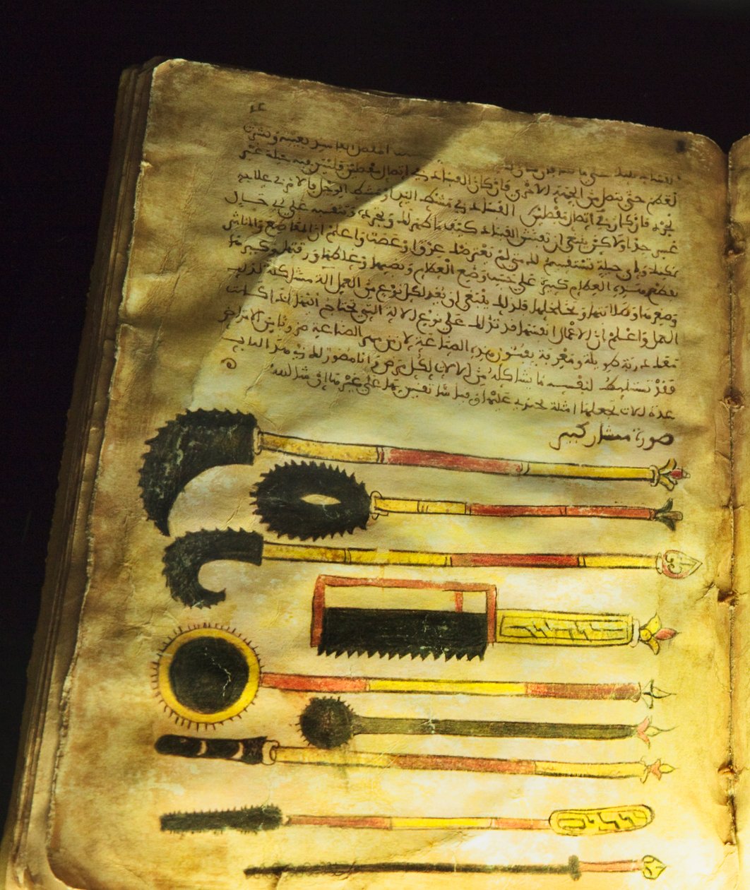 Illustrasjon fra "On Surgery and Instruments" eller "Al-Zahrawi", av Abu al-Qasim al-Zahrawi av Unbekannt Unbekannt