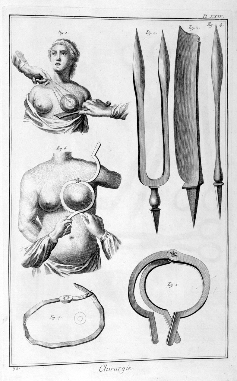 Brystkirurgi, 1751-1777 av Unbekannt