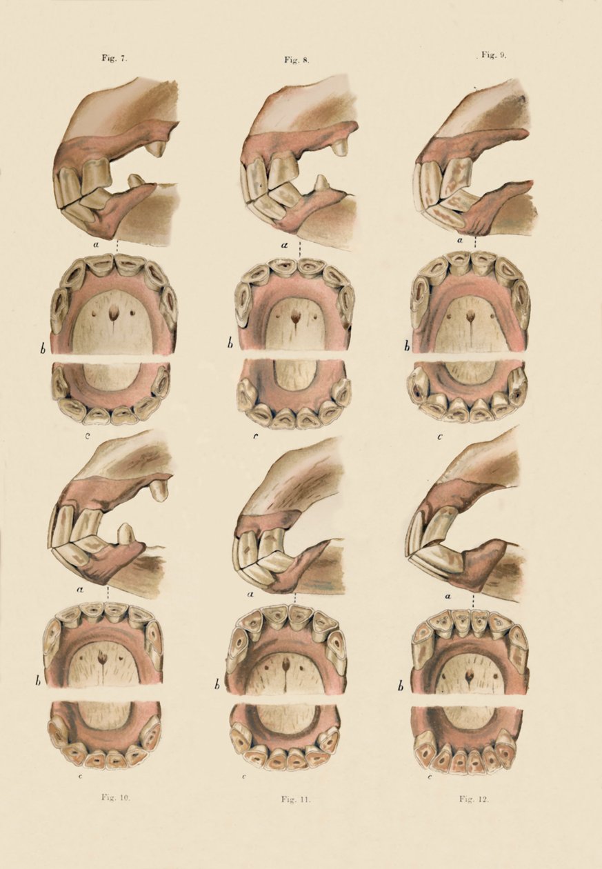 Beskrivelse av plate som viser alderen, som angitt av tennene, c1879. av Unbekannt