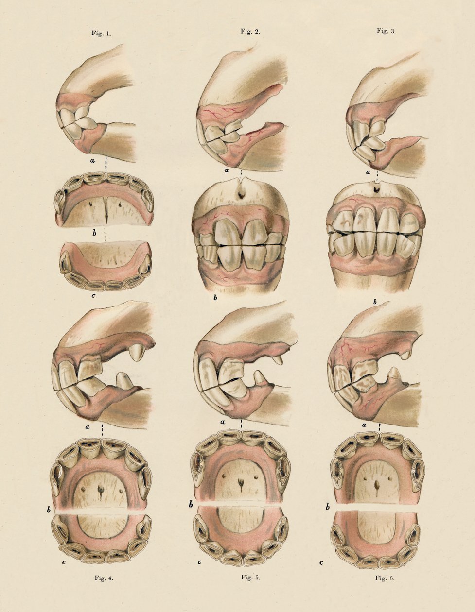 Beskrivelse av plate som viser alderen, som angitt av tennene, c1879. av Unbekannt