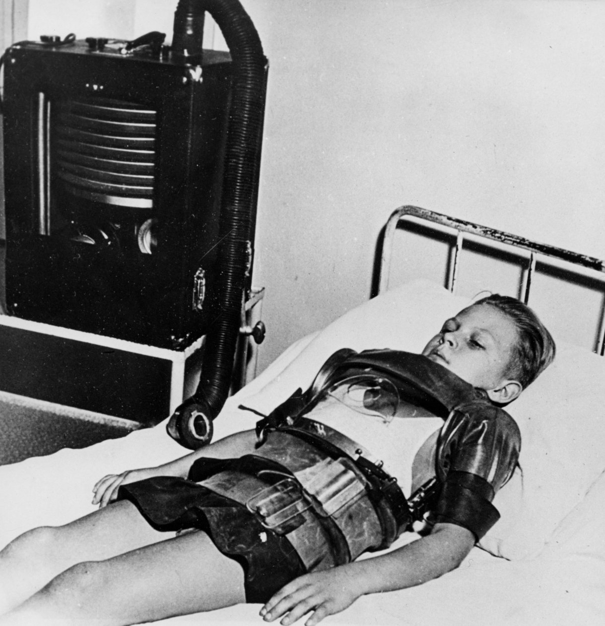 Elleve år gammel gutt i en jernlunge, Beaujon Hospital, Paris, c1947-1951 av Unbekannt