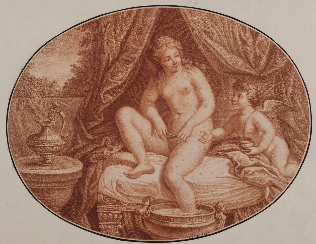 Epilering, 1700-tallet. av Unbekannt