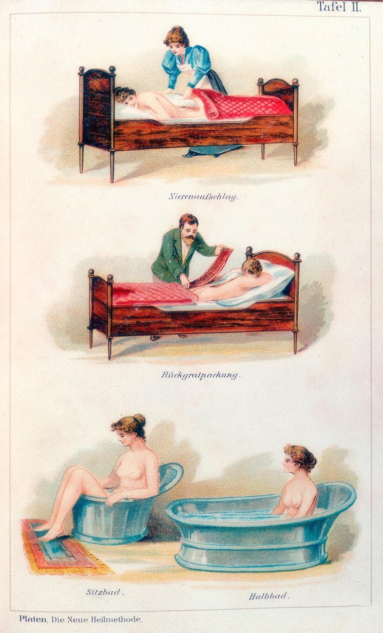 Hydroterapibehandlinger, c1902 av Unbekannt