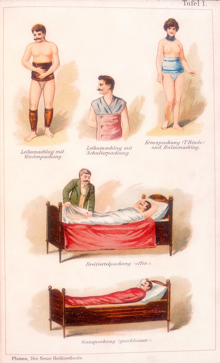 Hydroterapibehandlinger, c1902 av Unbekannt