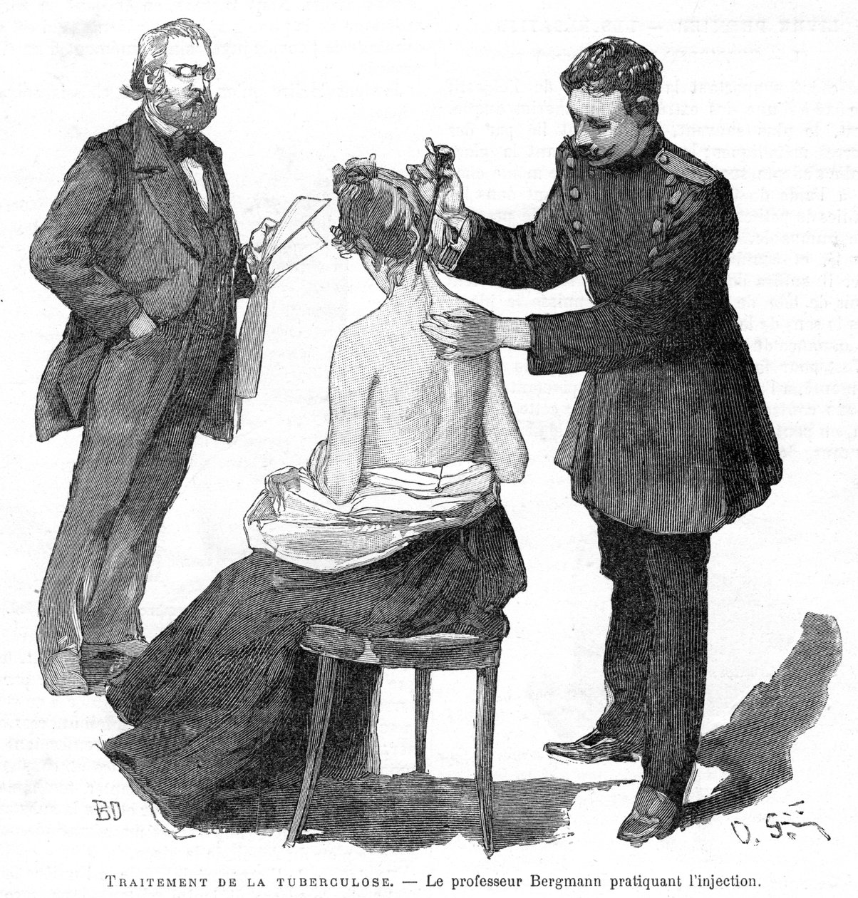 Professor Bergmann injiserer en tuberkulosepasient, 1891 av Unbekannt