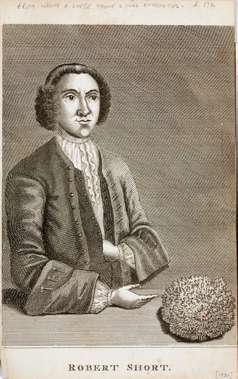 Robert Short, medisinsk nysgjerrighet, ca 1750-tallet av Unbekannt