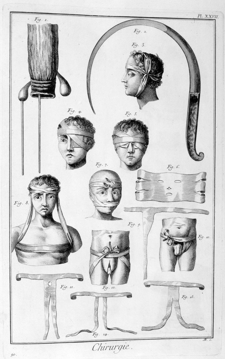 Kirurgi, 1751-1777 av Unbekannt