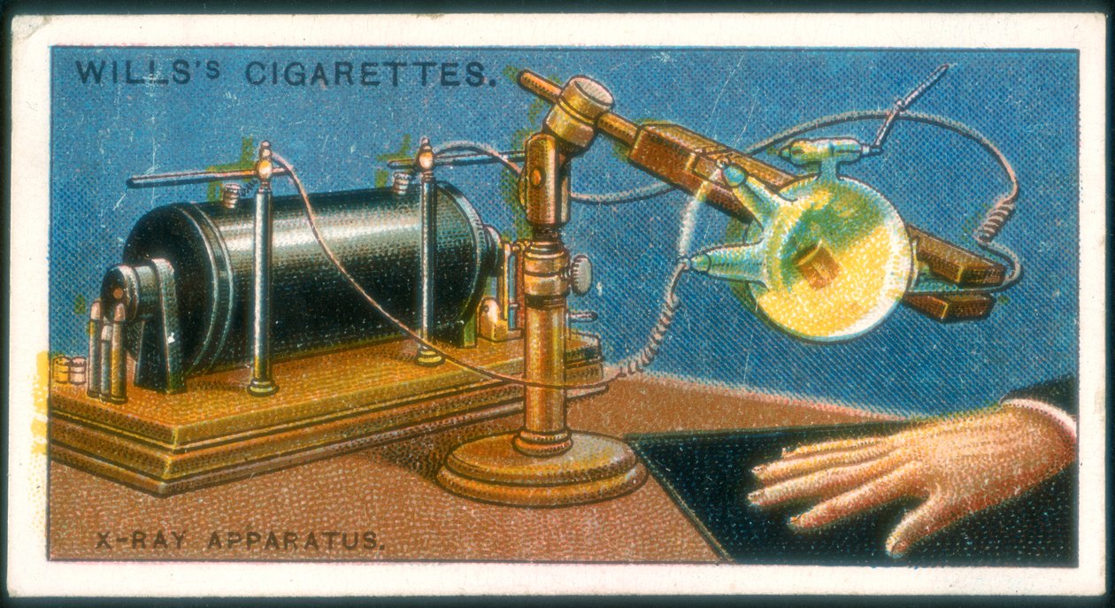 Røntgenapparat, 1915 av Unbekannt