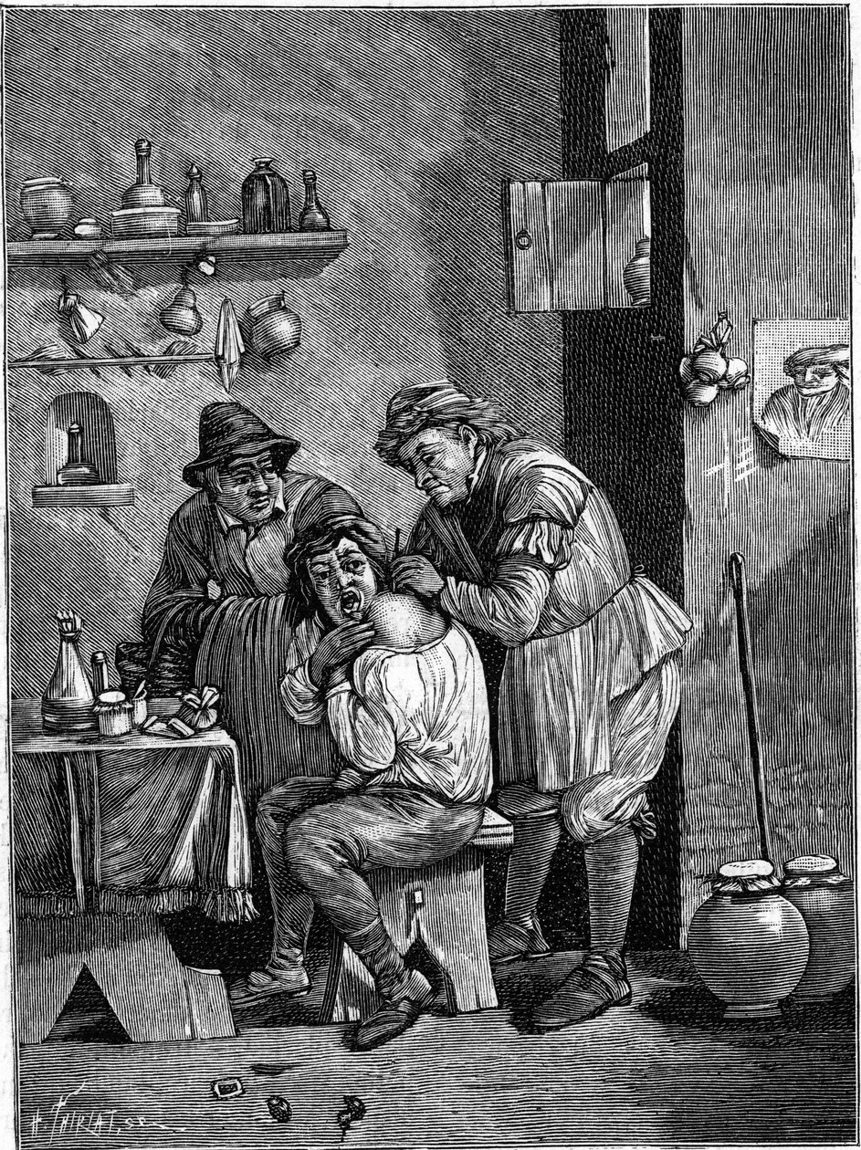 A charlatan surgeon in the 18th century examining a shoulder injury. (From an engraving of time). Engraving in “” La Nature: revue des sciences et de leurs applications aux arts et a l