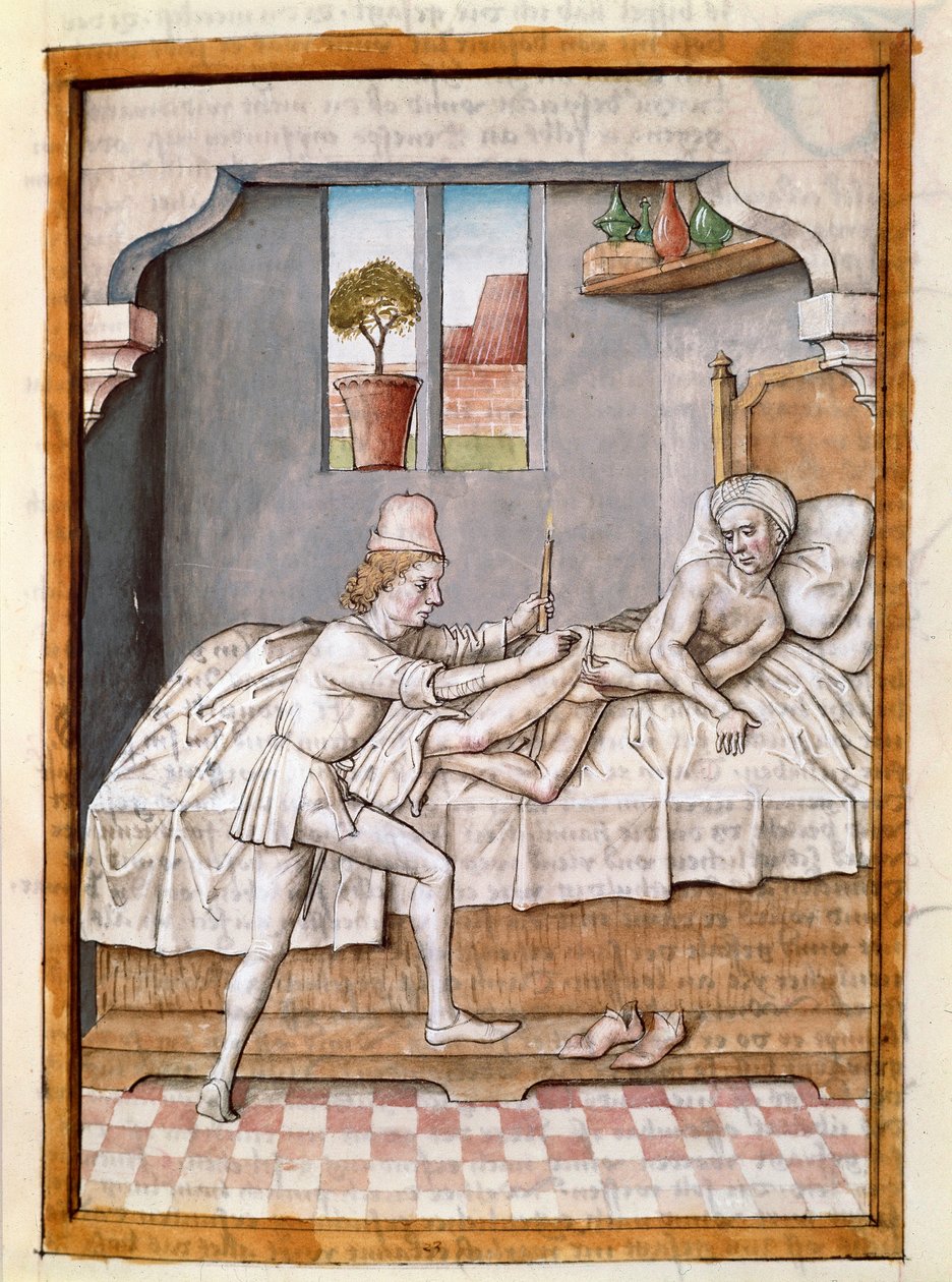 En lege behandler en miniatyrpasient fra en tysk oversettelse av fablene om "Kalila (Calila) og Dimna" av Bidpai. (ms. 1389, fol. 23) rundt 1480 Chantilly, museum Conde av Unknown artist