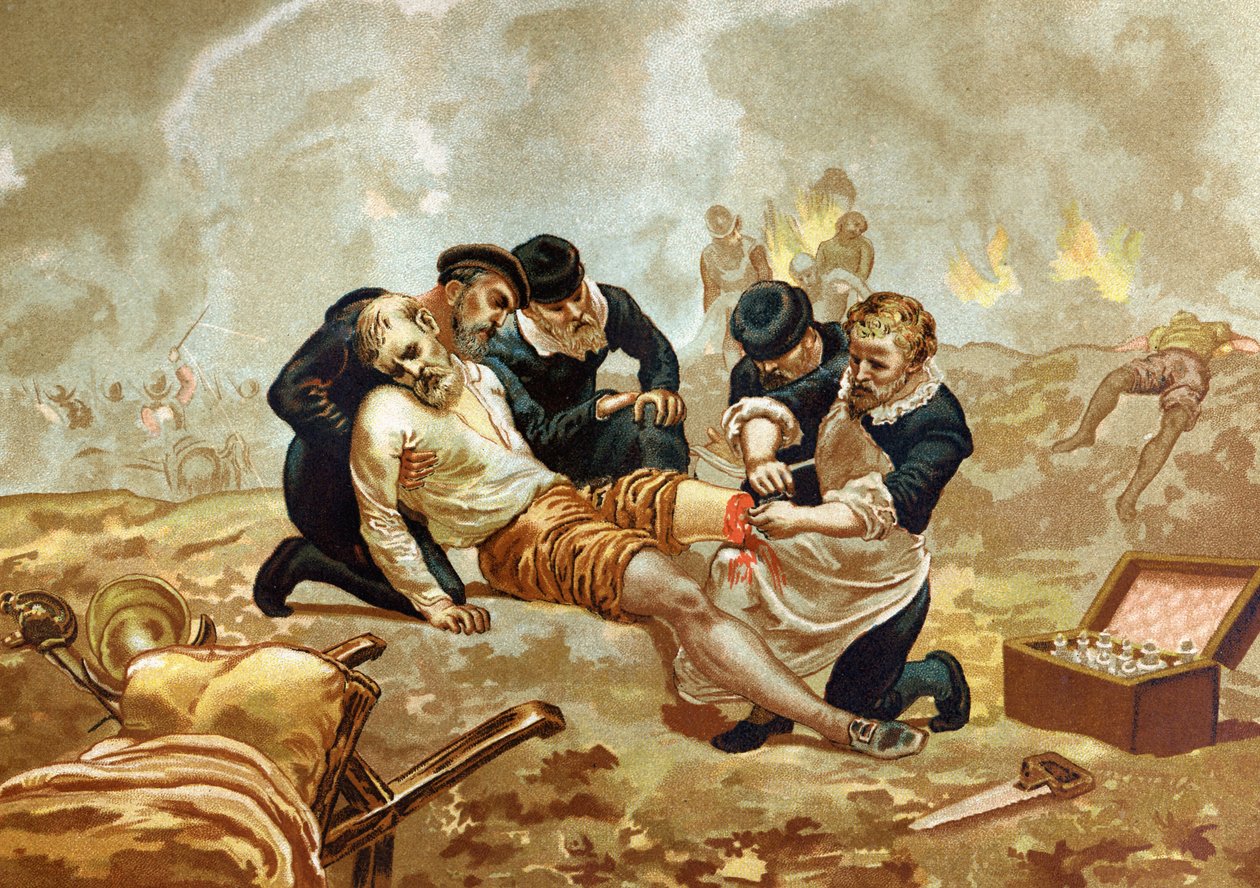 Ambroise Pare Medicin and French surgeon (c. 1509-1590) practices ligation of arteres after amputation. of after hombres y Mujeres celebres. Barcelona 1877. av Unknown artist