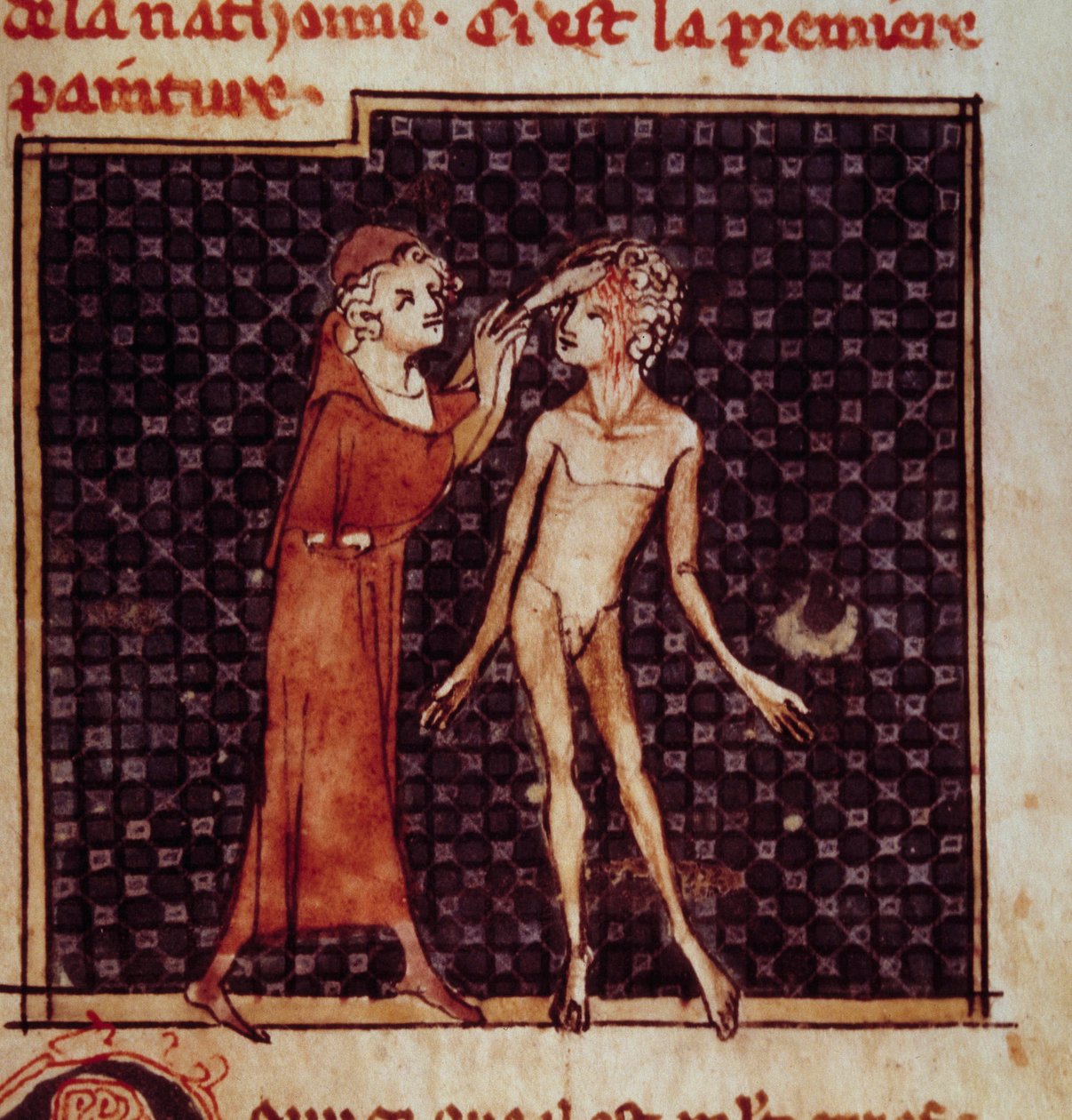 Anatomisk figur: Kirurgen snitter en pasients panne. Miniatyr fra manuskriptet "" Surgery" (Folio 8) skrevet av Henri de Mondeville (kirurg ved Philippe Le Bel professor i anatomi) av Unknown artist