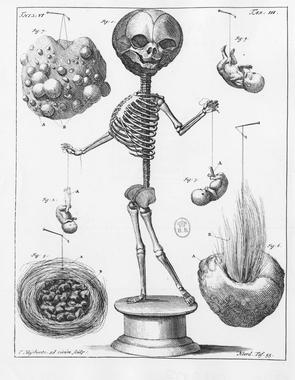 Anatomisk plate som representerer et skjelett, av Frederik Ruysch (1638-1731), nederlandsk anatom. av Unknown artist