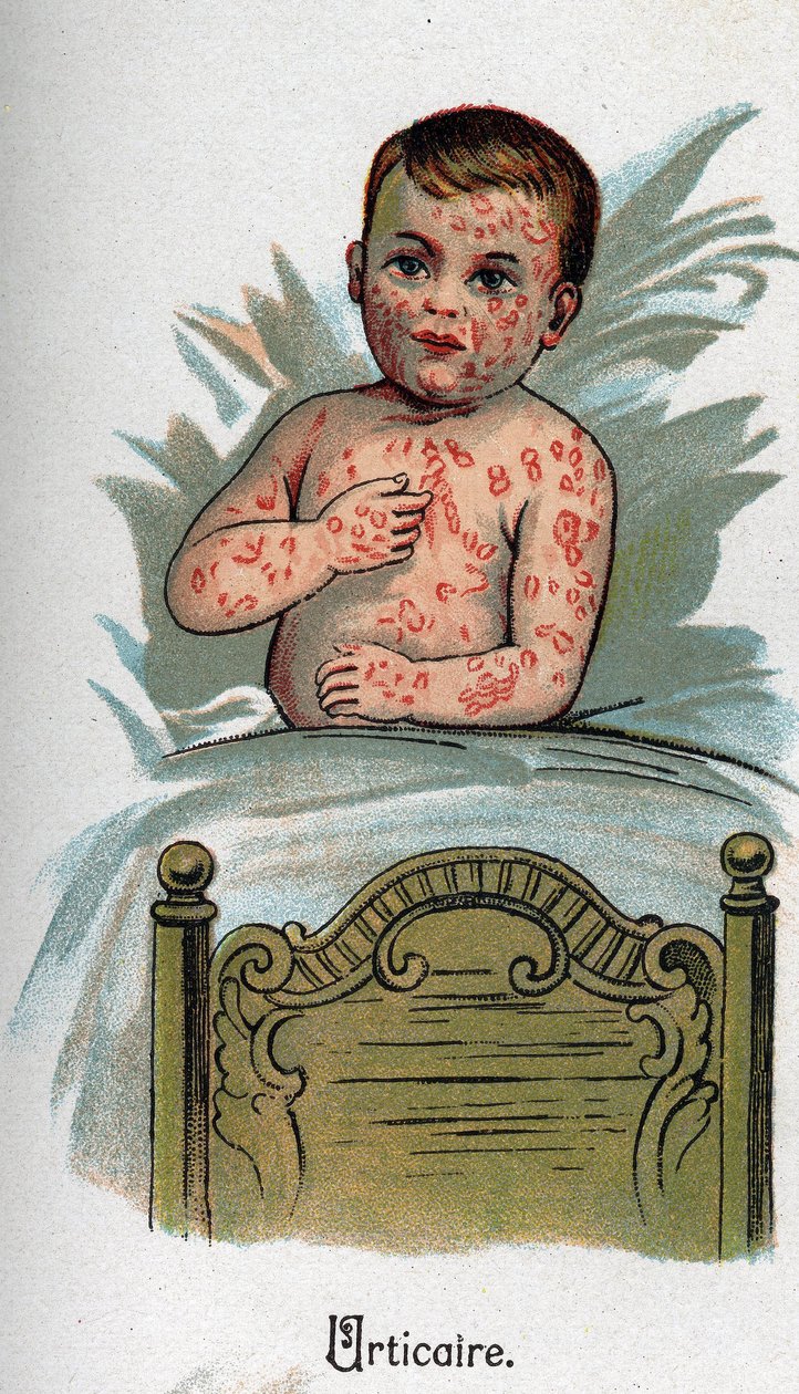 Barnesykdommer: Elveblest. I "Den nye naturmedisinen"" av F.E. Bilz. av Unknown artist