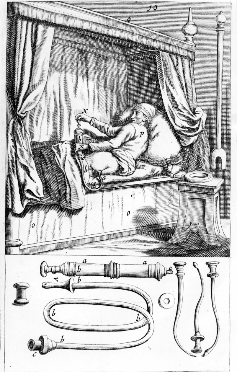 Clystère (for klyster) av Johannes Sculptetus "" Armamentarium Surgical"". Venezia 1665 av Unknown artist