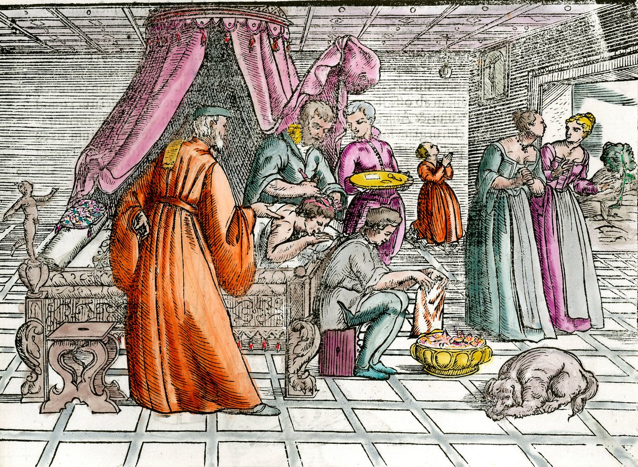 Lege: "" En trepanasjon""" En kirurg opererer pasientens hodeskalle. Gravering av privatsamlingen fra 1500-tallet av Unknown artist